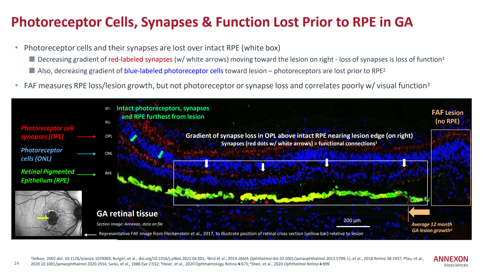 Photoreceptor Cells 