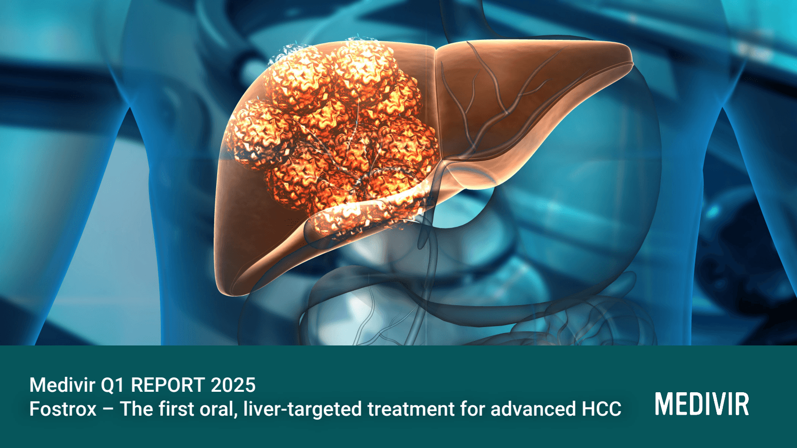 Medivir Q1 REPORT 20
